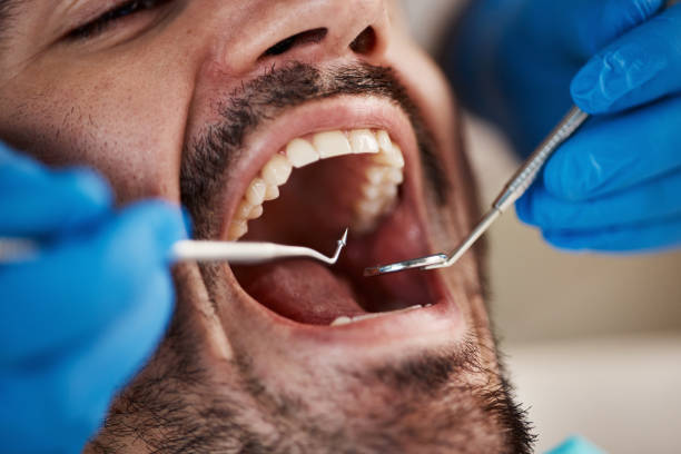 Best Emergency Dental Care for Abscessed Tooth in Tice, FL